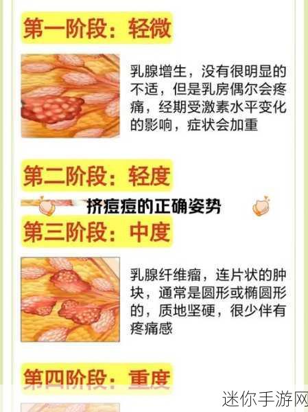 八重神子乳腺增生照片：八重神子的健康之路：乳腺增生的关注与护理指南